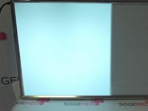 Negatoscope Titanox	84 x 47 2 Plages