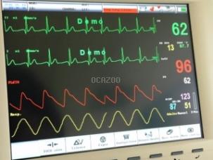 Cardiotocographe gémellaire SG5000 NEUF foetal