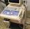 Echographe ALOKA 1100